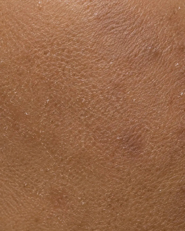 Rough Texture / Tan / Dead Skin